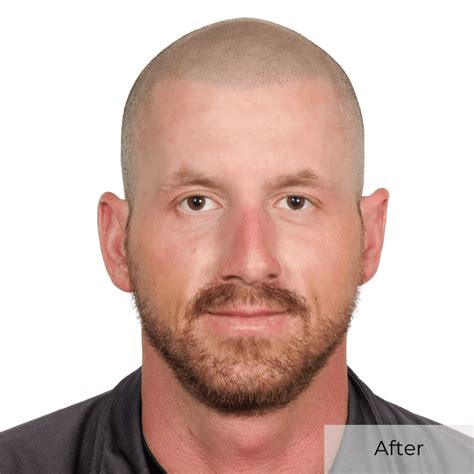 scalp micropigmentation albuquerque|Good Look Ink Scalp Micropigmentation Albuquerque, NM.